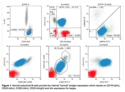 flow cytometry leukemia/lymphoma panel results|Interpreting Your Leukemia Blood Test Results .